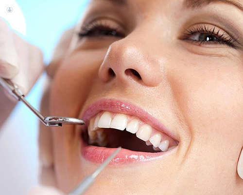 Cosmetic Dentist Tampa