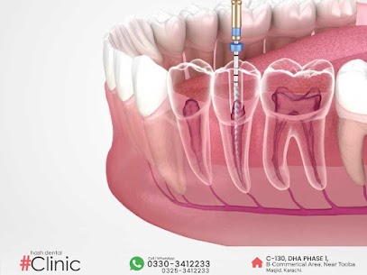 Dental Implants & Teeth Aligners: Best Solutions for a Perfect Smile