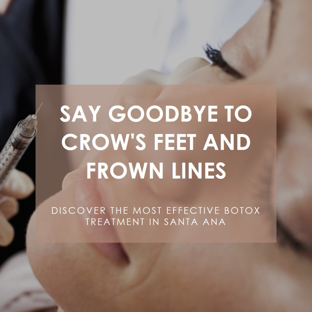 botox treatment in santa ana