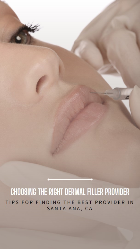 Dermal Fillers Treatment Santa Ana, CA