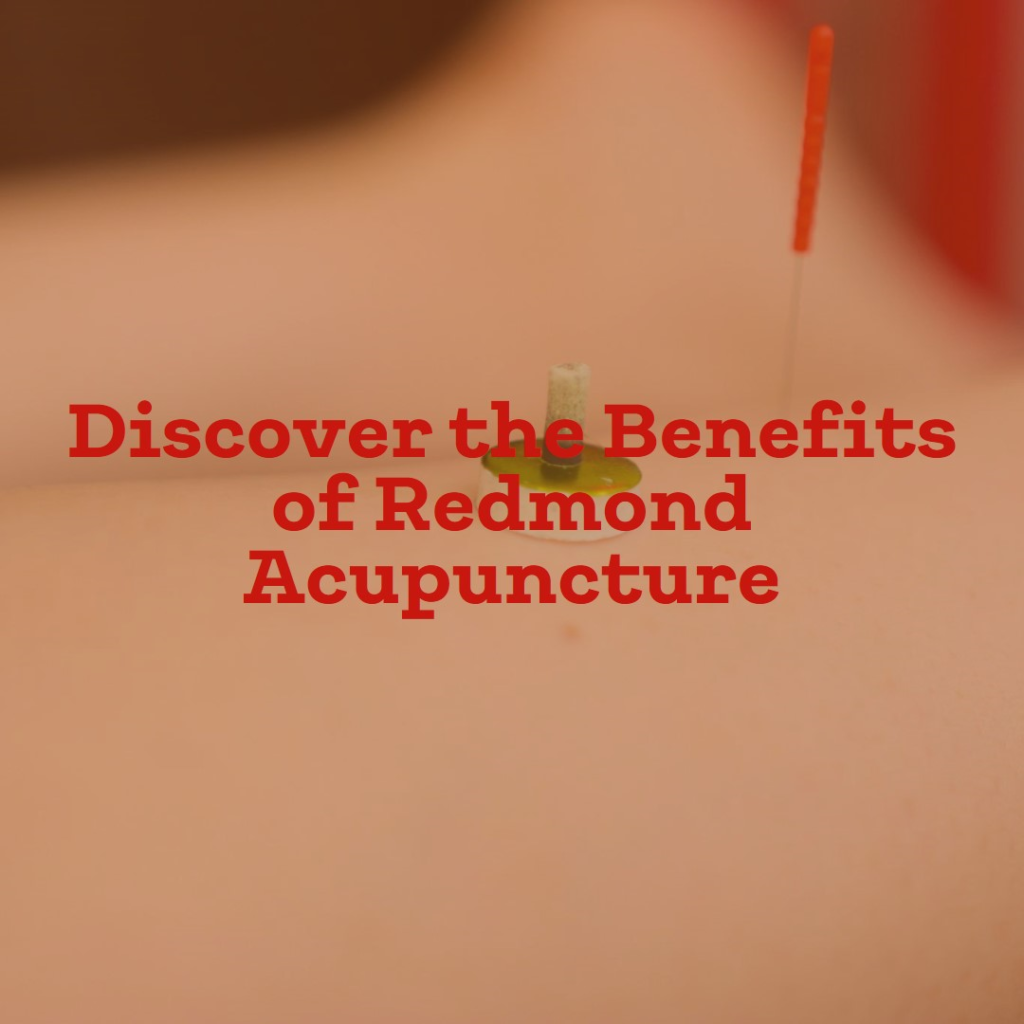 Redmond acupuncture