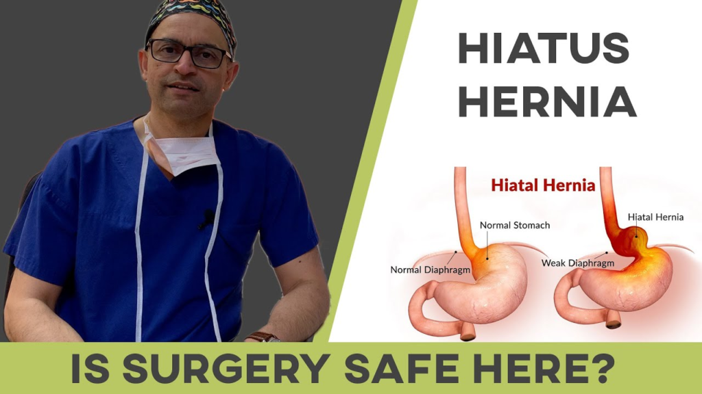 Hernia Surgeons in Dubai